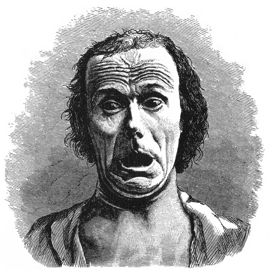 19th-century engraving of a face in an exaggerated expression of fear, from Duchenne's studies