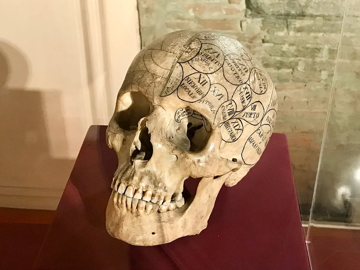 A human skull on display